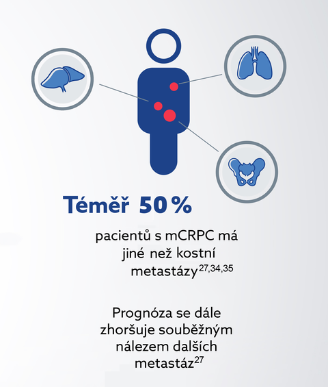 Přípravek Pluvicto® - indikace Přípravek Pluvicto® - indikace