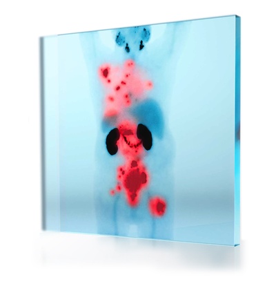 Zobrazení pomocí metody PSMA PET umožní rozpoznat a cílit na PSMA pozitivní mCRPC Zobrazení pomocí metody PSMA PET umožní rozpoznat a cílit na PSMA pozitivní mCRPC