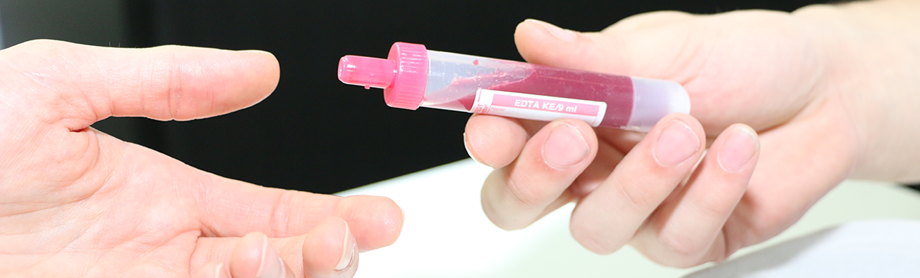 Novartis Hematologie Systémová mastocytóza (SM)